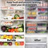 Fridge Storage Containers Plastic Freezer Storage Containers For Fish, Meat, Vegetables (Set Of 3)