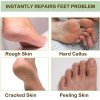 Silicone Spa Gel Socks for Cracked Heels Moisturizing Foot Hydration Socks for Men And Women